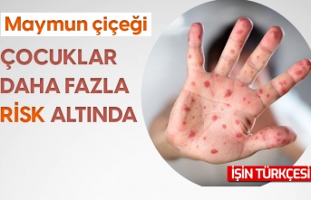 Maymun çiçeği virüsünde çocuklar daha fazla risk altında