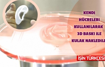 Kendi hücreleri kullanılarak 3D baskı ile kulak nakledildi