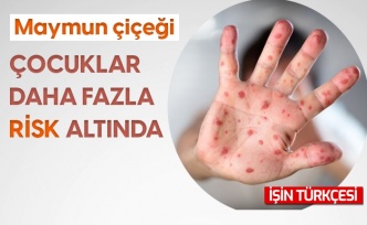 Maymun çiçeği virüsünde çocuklar daha fazla risk altında